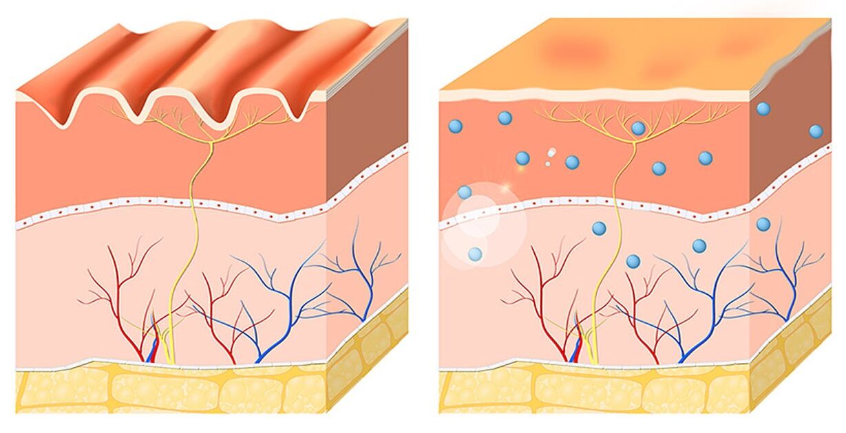 Inno Gialuron ani ati ki o moisturizes awọn epidermis