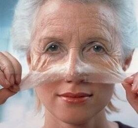 Atunṣe ti awọ ara ti oju pẹlu laser