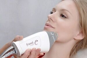 Pataki ti ilana isọdọtun awọ oju ida