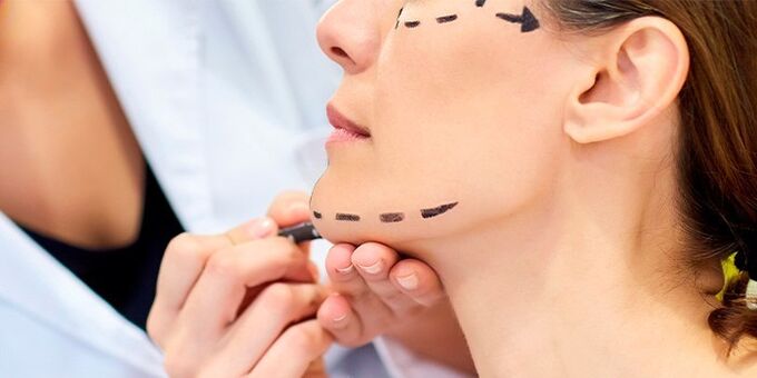Dókítà máa ń múra aláìsàn kan sílẹ̀ fún iṣẹ́ abẹ