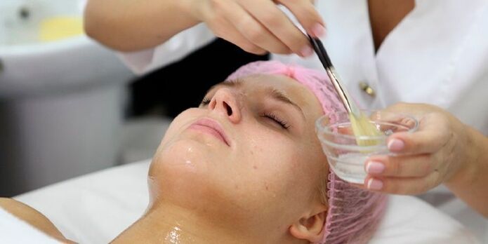 Obinrin kan gba ilana peeling